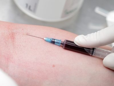 Non-Invasive Blood Test for Non-Alcoholic for Liver Disease