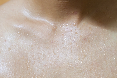 Microfluidic Skin Patch Serves as Remote Sweat Testing Lab