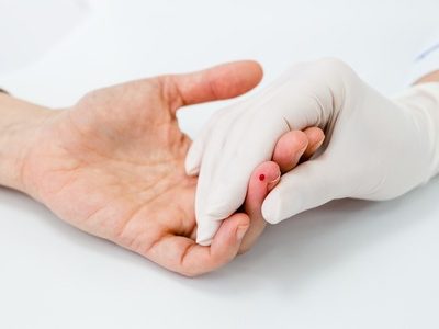 New HIV Testing USB Stick Gives Results in 20 Minutes