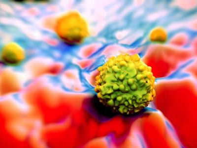 Artificial Intelligence Used to Gain Deeper Understanding of Cancer Biophysics