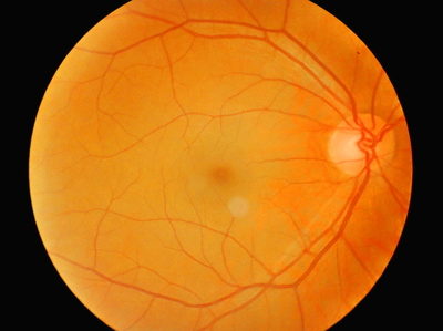 National Eye Institute Launches $1 Million 3-D Retina Organoid Challenge