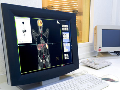 Noninvasive PET Imaging Used to Determine Likely Response to Immunotherapy