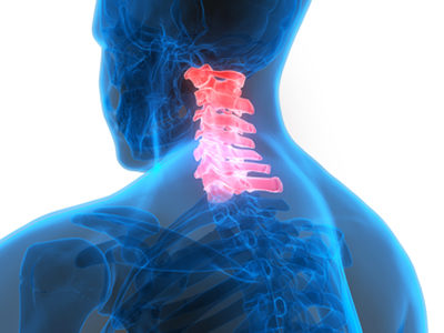 New Method of Differentiating Stem Cells Could be Used to Treat Degenerative Disc Disease
