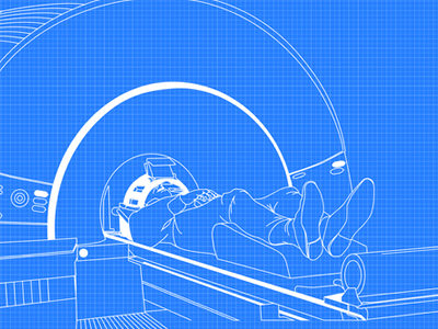 fMRI Analytical Imaging Technology Identifies Cerebral Vascular Disorders Without Contrast Agents
