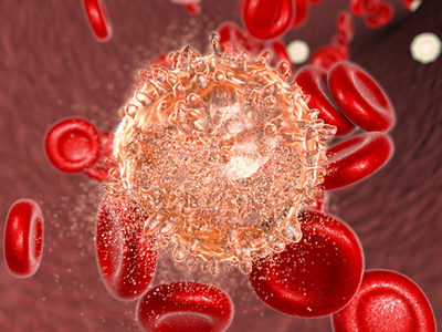 Cancer Cells Can Hijack Genes from Other Cells to Metastasize