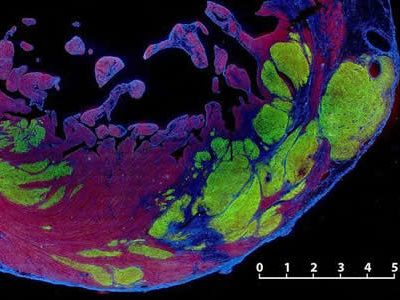 Stem Cells Restore Heart Function in Monkeys with Heart Failure