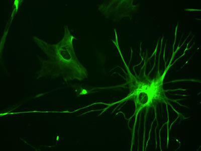 New Technique Allows Researchers to Grow Human Astrocytes in Just Two Weeks