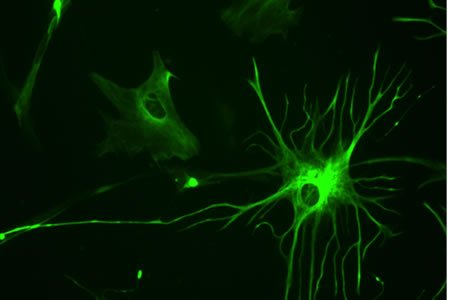 New Technique Allows Researchers to Grow Human Astrocytes in Just Two Weeks