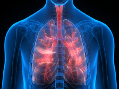 AI-Based System Can Detect More than 90% of Lung Cancers from a Blood Test