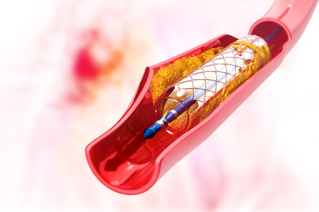 Advances Made in the Generation of Functional Arteries from Stem Cells