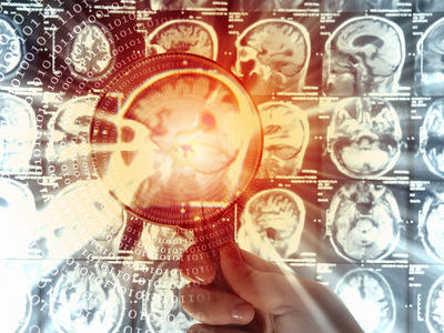 Drug Used to Treat an Enlarged Prostate Shown to Slow Progression of Parkinson’s Disease