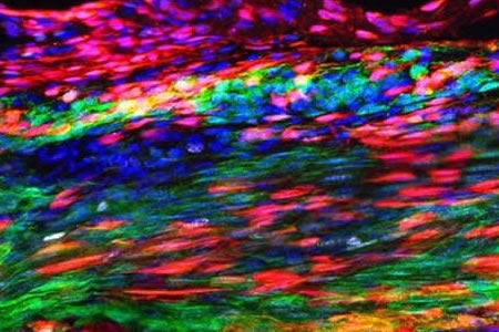 Tendon Stem Cell Discovery Could Lead to New Treatments for Tendon Injuries to Improve Outcomes and Recovery Time