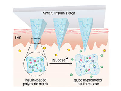 24-Hour Smart Insulin Patch Monitors and Manages Glucose to Control Diabetes