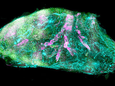Researchers Turn Human Organ Transparent and Create 3D Organ Maps at the Cellular Resolution