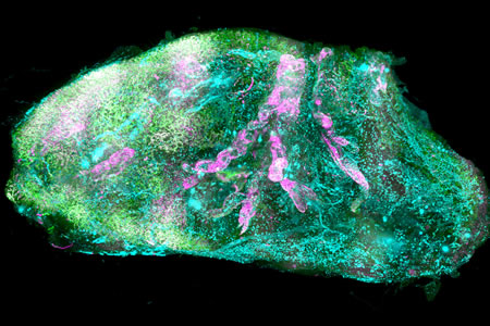 Researchers Turn Human Organ Transparent and Create 3D Organ Maps at the Cellular Resolution