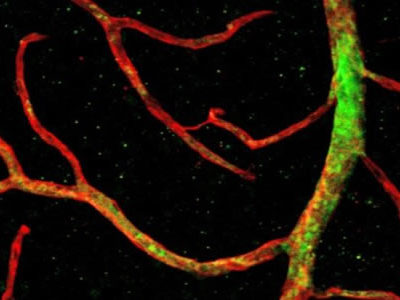 Efficient Revascularization of the Retina Using Primitive Stem Cells