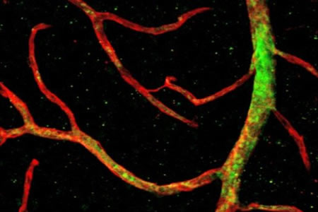 Efficient Revascularization of the Retina Using Primitive Stem Cells
