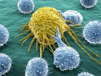 Natural Killer Immune Cells Edited to Improve Effectiveness at Targeting Cancer Cells