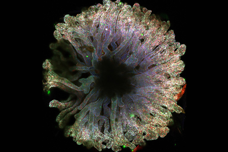 New Approach Used to Generate Functional Kidney Organoids for Research and Drug Screening