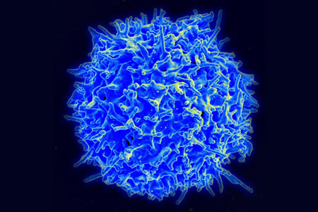 Transcription Factor Overexpressed to Make T Cells Capable of Fighting Exhaustion