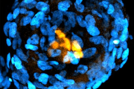Embryo-like Structures Created from Stem Cells Could Serve as Alternative to Donated Embryos