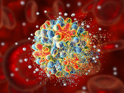Nanoparticle-based Treatment Show Promise in Mouse Models of Sepsis